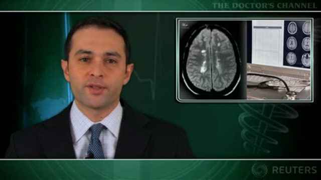 Demyelinating pathology on MRI may precede MS symptoms Thumbnail