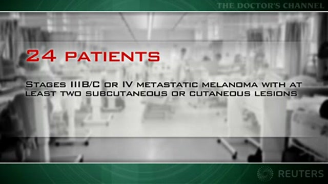 IL-12 gene transfer by electroporation promising for melanoma Thumbnail