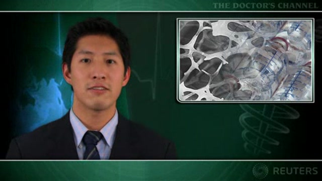 Annual zoledronate injection effective for HIV-associated bone loss Thumbnail