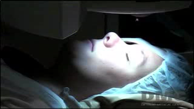 Lasik Eye Surgery Thumbnail