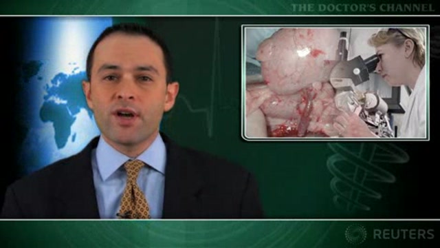 Kidney donation appears safe in long term Thumbnail