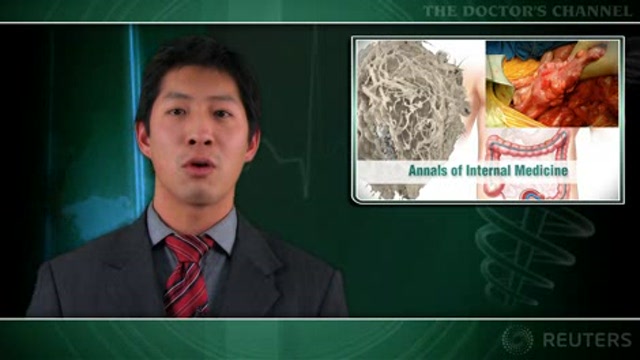 Immunochemical fecal blood tests differ widely in performance Thumbnail