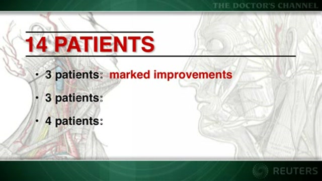 Occipital nerve stimulation may ease intractable cluster headache Thumbnail
