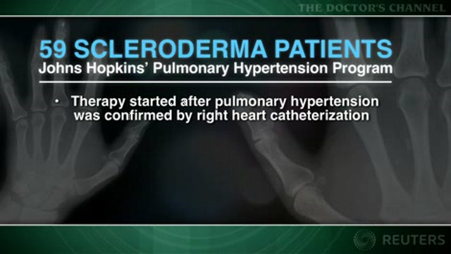 Mortality high in patients with systemic scleroderma and pulmonary hypertension Thumbnail