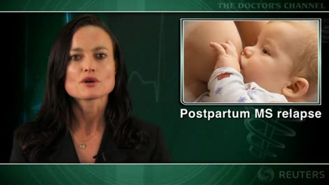Exclusive breastfeeding may reduce postpartum MS relapse Thumbnail