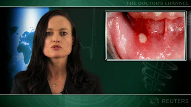 Vitamin B12 useful for recurrent aphthous stomatitis Thumbnail