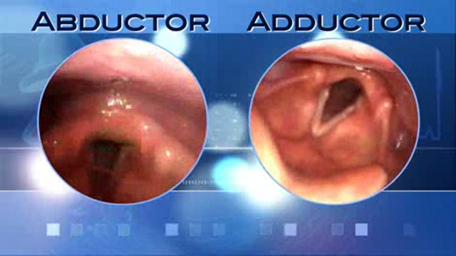 Spasmodic Dysphonia Thumbnail