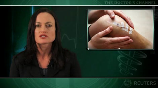 Boys and girls equally likely to resume sports after ACL repair Thumbnail