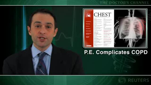 Pulmonary embolism prevalent in COPD flare-ups Thumbnail