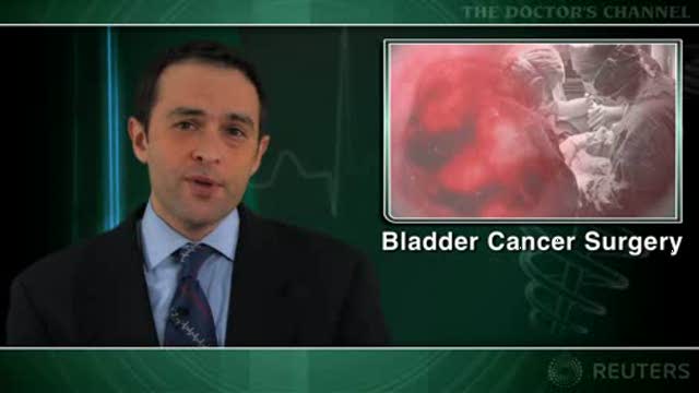 Delayed surgery for bladder cancer increases mortality Thumbnail