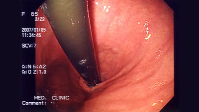 Technological Advances in Urology Thumbnail