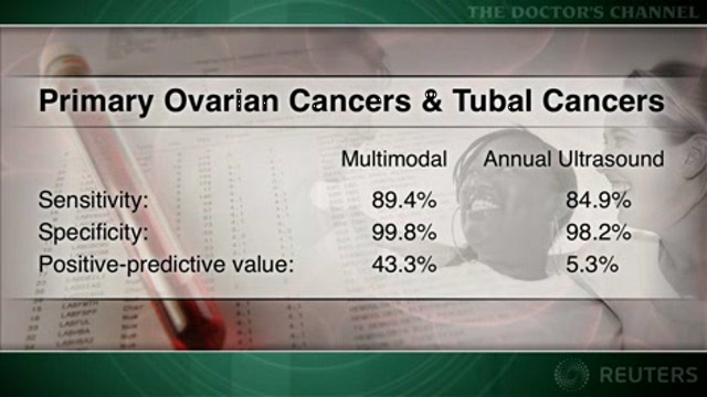 CA125 and ultrasound effective for ovarian cancer screening Thumbnail