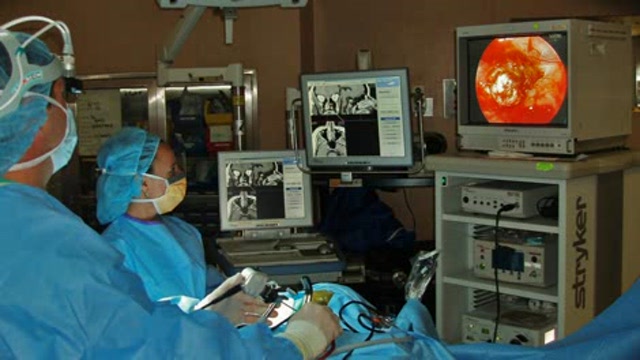 Image Guided Endoscopic Sinus Surgery Thumbnail