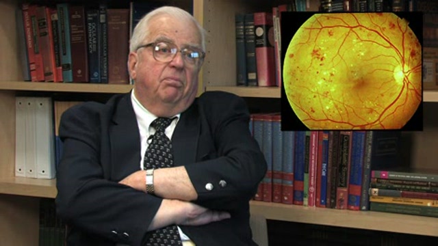 Optic Neuritis Thumbnail