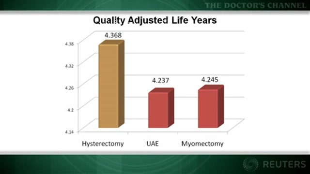Hysterectomy most cost-effective fibroid treatment Thumbnail