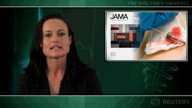 Chlorhexidine dressings reduce catheter-related infections Thumbnail