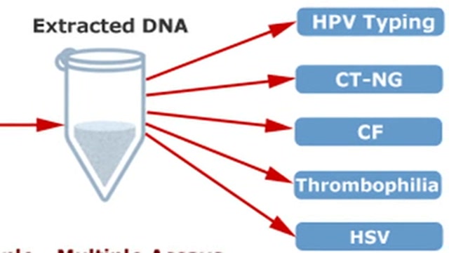 Cervical cancer screening Thumbnail