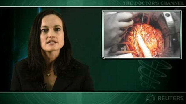 Ventricular reduction surgery with CABG does not improve outcomes Thumbnail