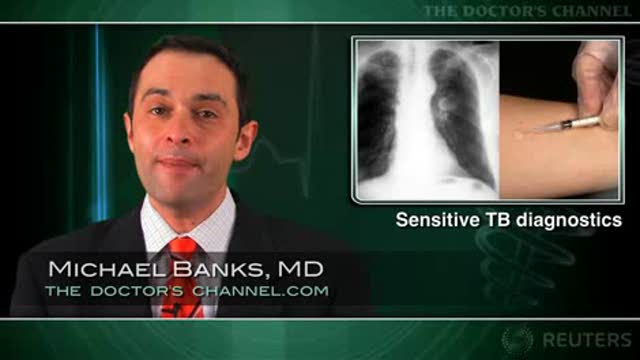 Interferon release assays may be "gold standard" for latent TB detection Thumbnail