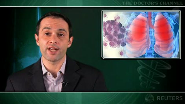 Stereotactic radiotherapy effective in early inoperable lung cancer Thumbnail