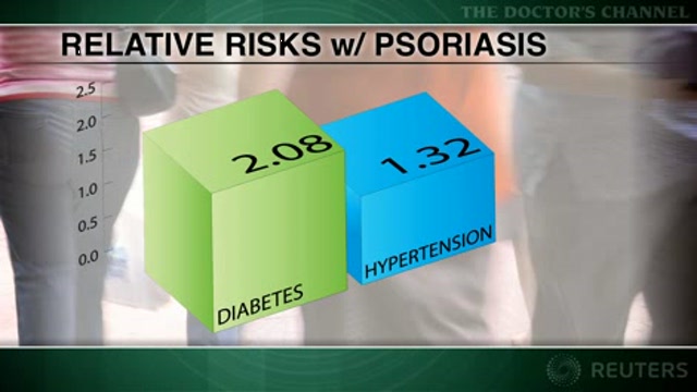 Psoriasis associated with increased risk of diabetes and hypertension Thumbnail