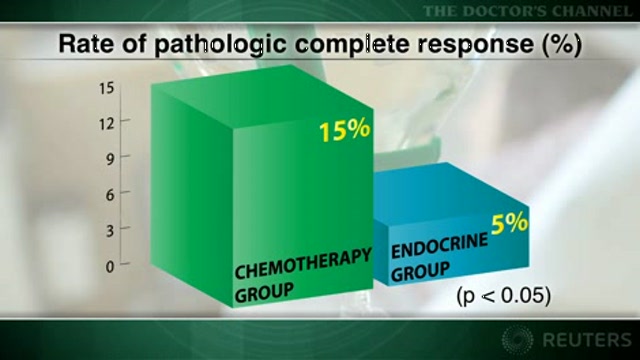 Triple-negative breast cancer responds best to neoadjuvant therapy Thumbnail