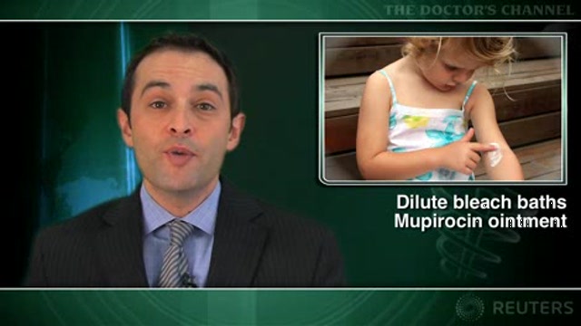 Dilute bleach baths plus intranasal mupirocin eases eczema severity in children Thumbnail