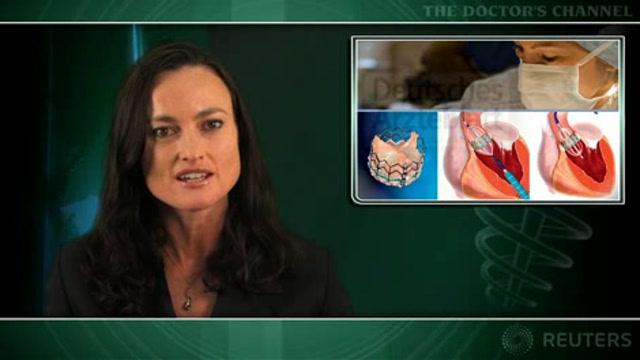 Catheter-based aortic valve implantation useful for high-risk patients Thumbnail