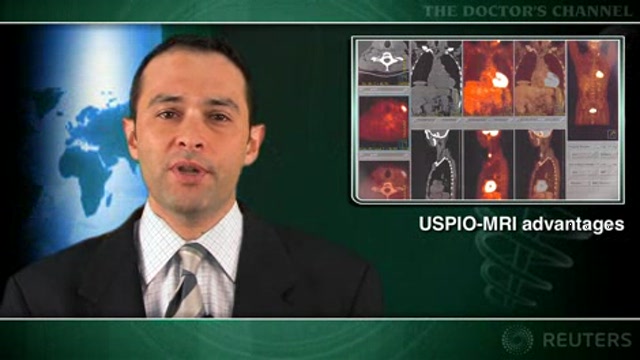Atorvastatin reduces carotid plaque inflammation on MRI Thumbnail
