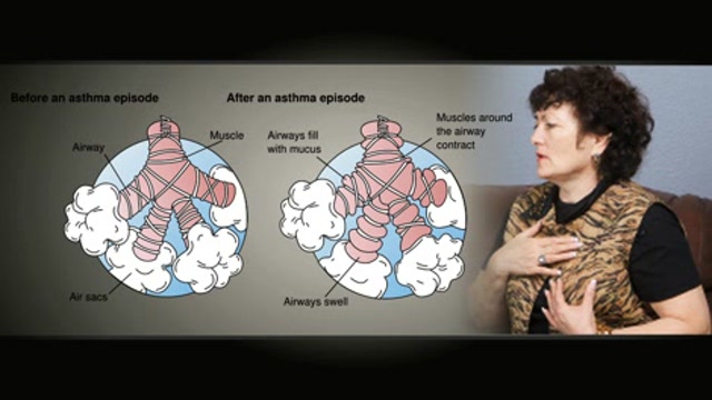 Asthma Diagnosis Thumbnail