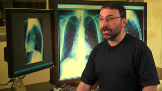 The art of history taking in asthma Thumbnail