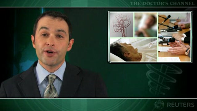 Comparable effects seen with tPA in male and female stroke patients Thumbnail