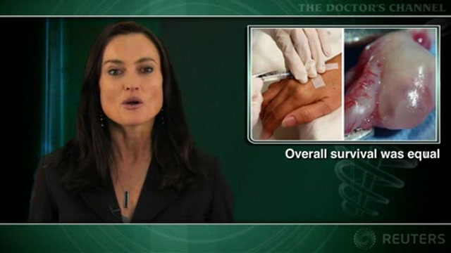 No benefit to treating ovarian cancer relapse based on rising CA125 alone Thumbnail