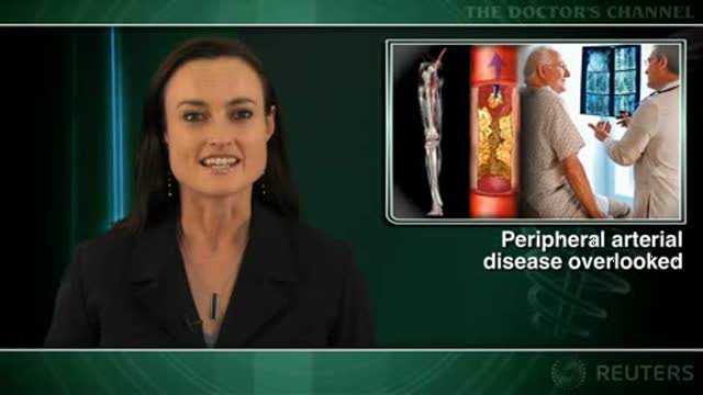 Peripheral arterial disease often overlooked in heart disease patients Thumbnail
