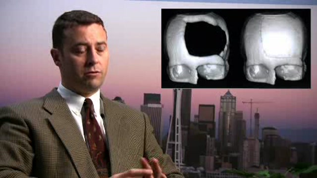 Advances in Imaging Craniofacial Features Thumbnail