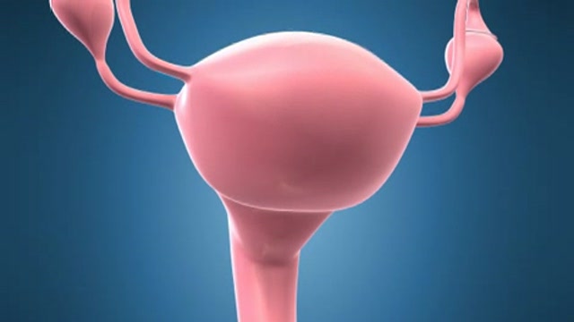 Endometrial ablation has a high failure rate Thumbnail