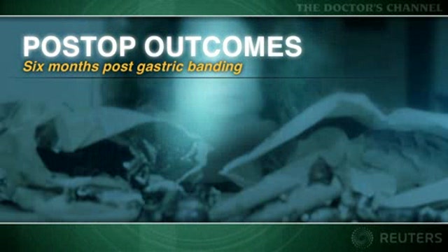 Gastric banding improves metabolic parameters in obese teenagers Thumbnail