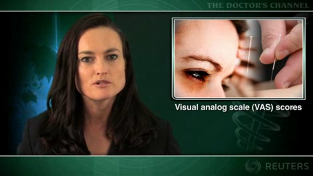 Controlled study shows acupuncture relieves acute migraine pain Thumbnail