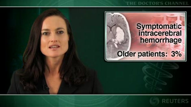 Thrombolysis safely improves outcomes in young stroke patients Thumbnail
