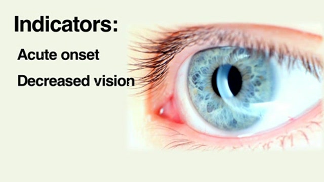 Red eye – when to refer to an ophthalmologist Thumbnail