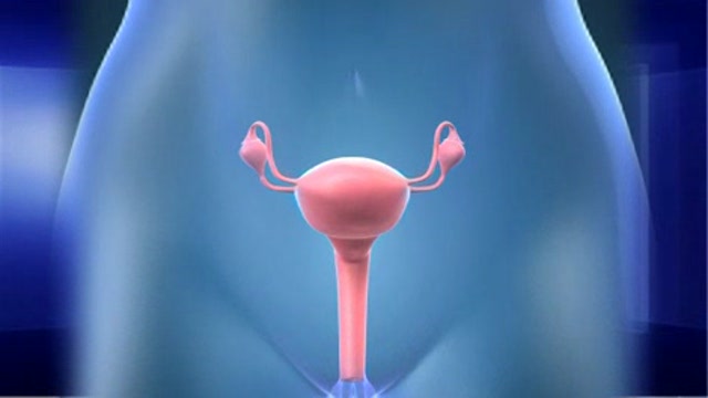Infertility and Polycystic Ovarian Syndrome Thumbnail