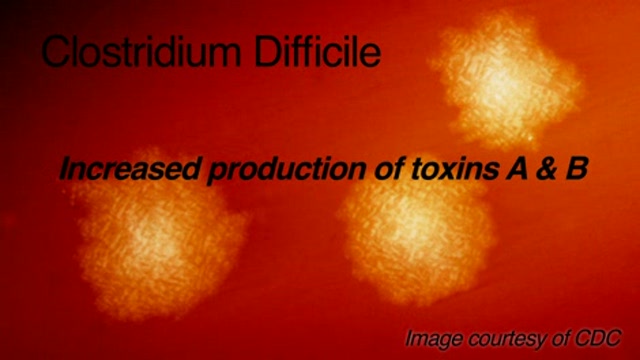 Clostridium Difficile – a new  hypervirulent strain Thumbnail