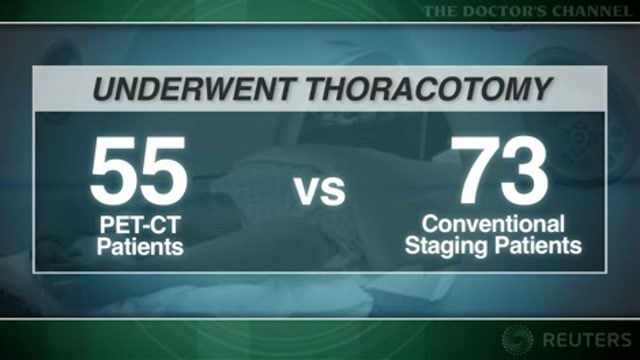 PET-CT improves preoperative staging of non-small cell lung cancer Thumbnail