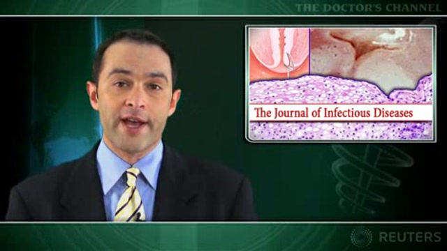 Loop electrosurgical excision may cut risk of new HPV infections Thumbnail