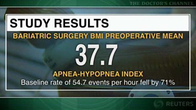 Surgical weight loss does not cure obstructive sleep apnea Thumbnail
