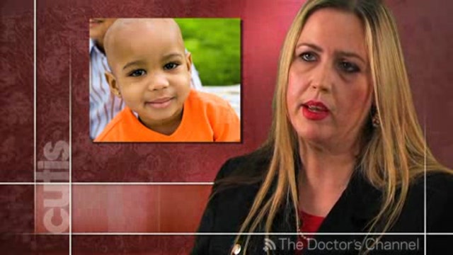 Alopecia areata treatment in children and adolescents Thumbnail