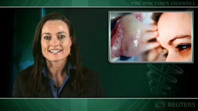 Hormone therapy linked to ovarian cancer Thumbnail