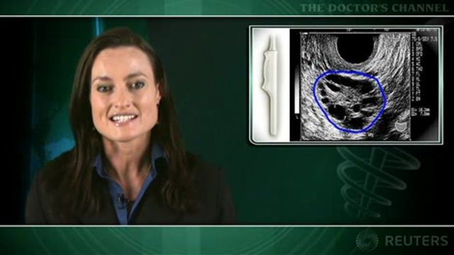 Ultrasound superior to symptoms for predicting ovarian cancer Thumbnail