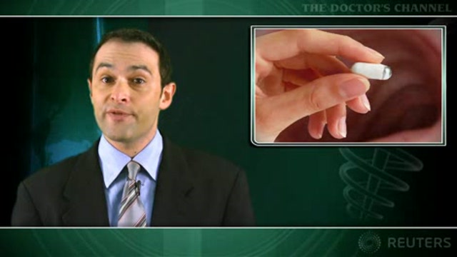 Capsule endoscopy lacks sensitivity of colonoscopy Thumbnail
