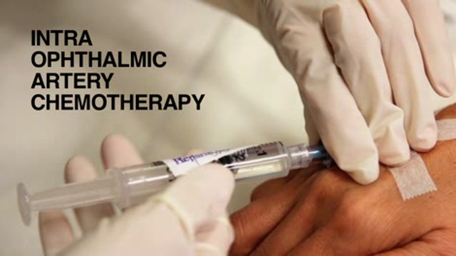 Retinoblastoma treatment options Thumbnail